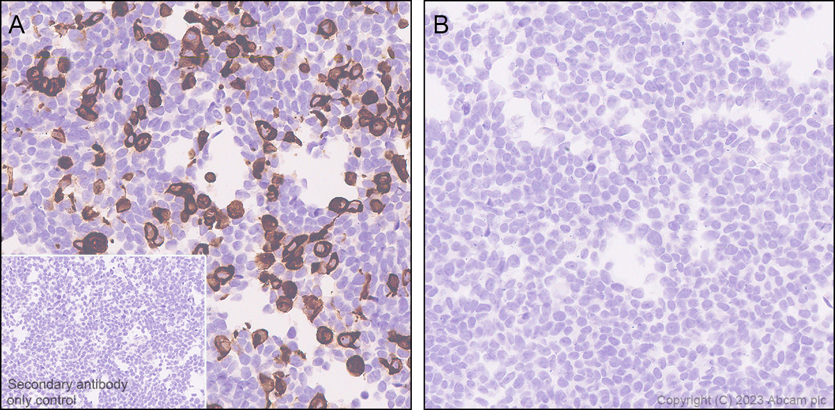 Immunohistochemistry (Formalin/PFA-fixed paraffin-embedded sections) - Anti-Streptococcus mutans Cell surface antigen I/II antibody [EPR28235-11] (AB316006), expandable thumbnail