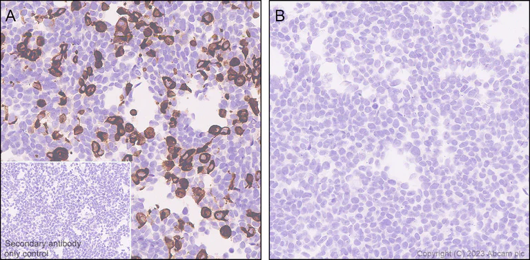 Immunohistochemistry (Formalin/PFA-fixed paraffin-embedded sections) - Anti-Streptococcus mutans Cell surface antigen I/II antibody [EPR28235-11] (AB316006)