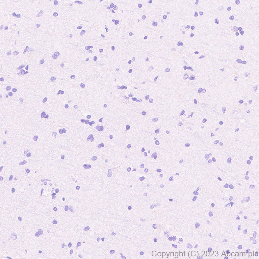 Immunohistochemistry (Formalin/PFA-fixed paraffin-embedded sections) - Anti-Streptococcus mutans Cell surface antigen I/II antibody [EPR28235-11] (AB316006), expandable thumbnail