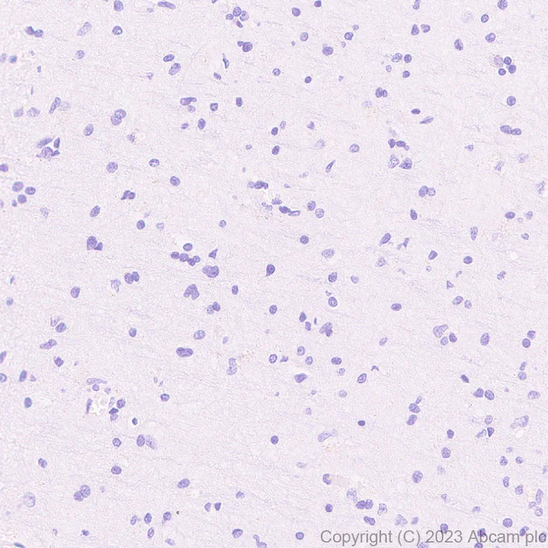 Immunohistochemistry (Formalin/PFA-fixed paraffin-embedded sections) - Anti-Streptococcus mutans Cell surface antigen I/II antibody [EPR28235-11] (AB316006)