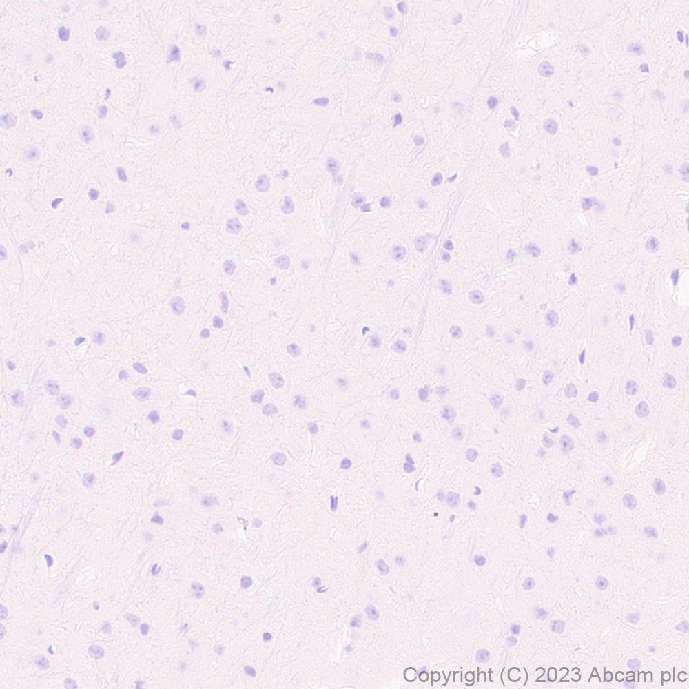 Immunohistochemistry (Formalin/PFA-fixed paraffin-embedded sections) - Anti-Streptococcus mutans Cell surface antigen I/II antibody [EPR28235-11] (AB316006), expandable thumbnail