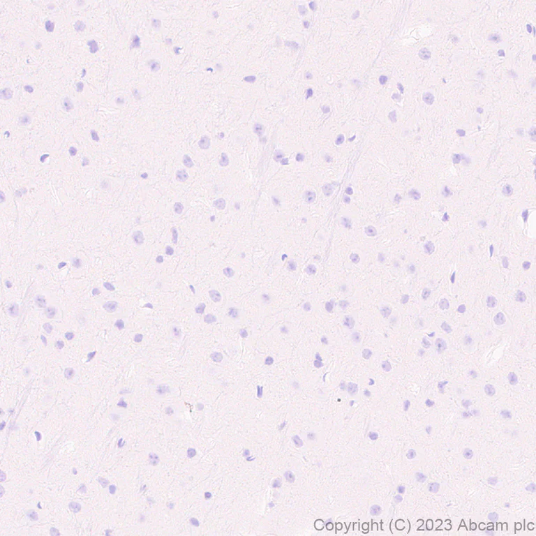 Immunohistochemistry (Formalin/PFA-fixed paraffin-embedded sections) - Anti-Streptococcus mutans Cell surface antigen I/II antibody [EPR28235-11] (AB316006)