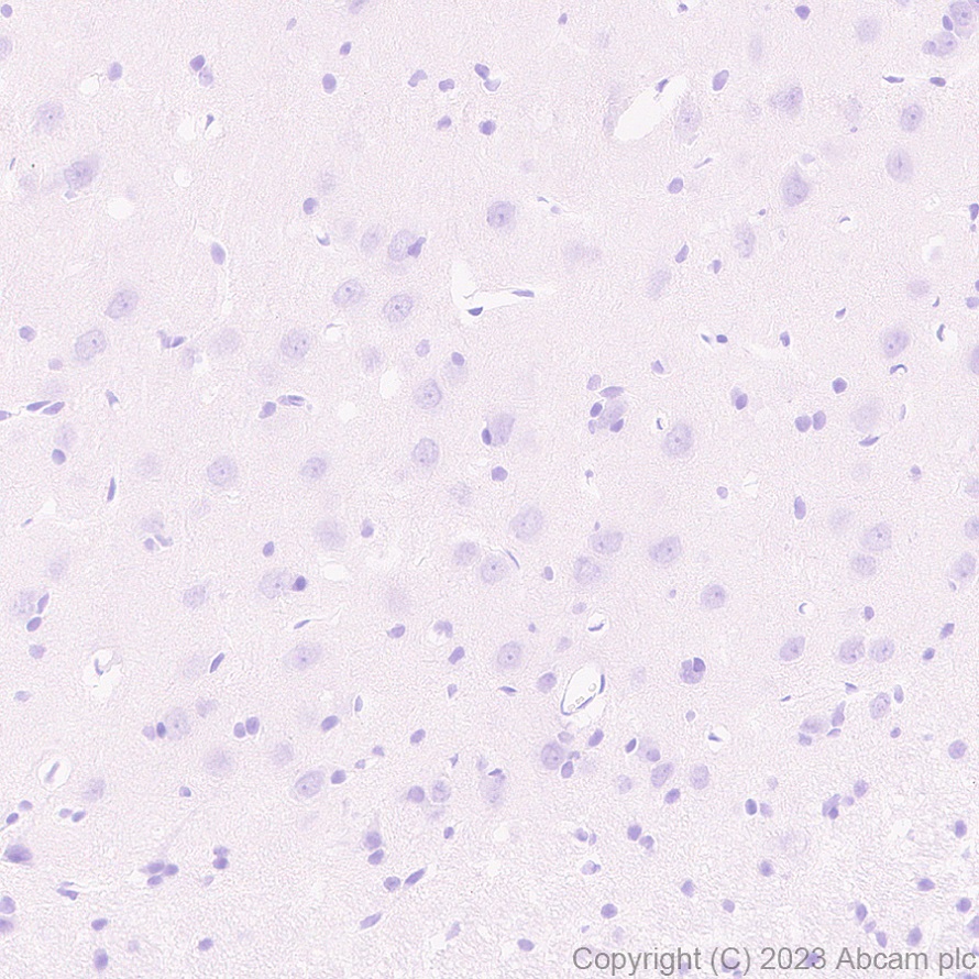 Immunohistochemistry (Formalin/PFA-fixed paraffin-embedded sections) - Anti-Streptococcus mutans Cell surface antigen I/II antibody [EPR28235-11] (AB316006), expandable thumbnail