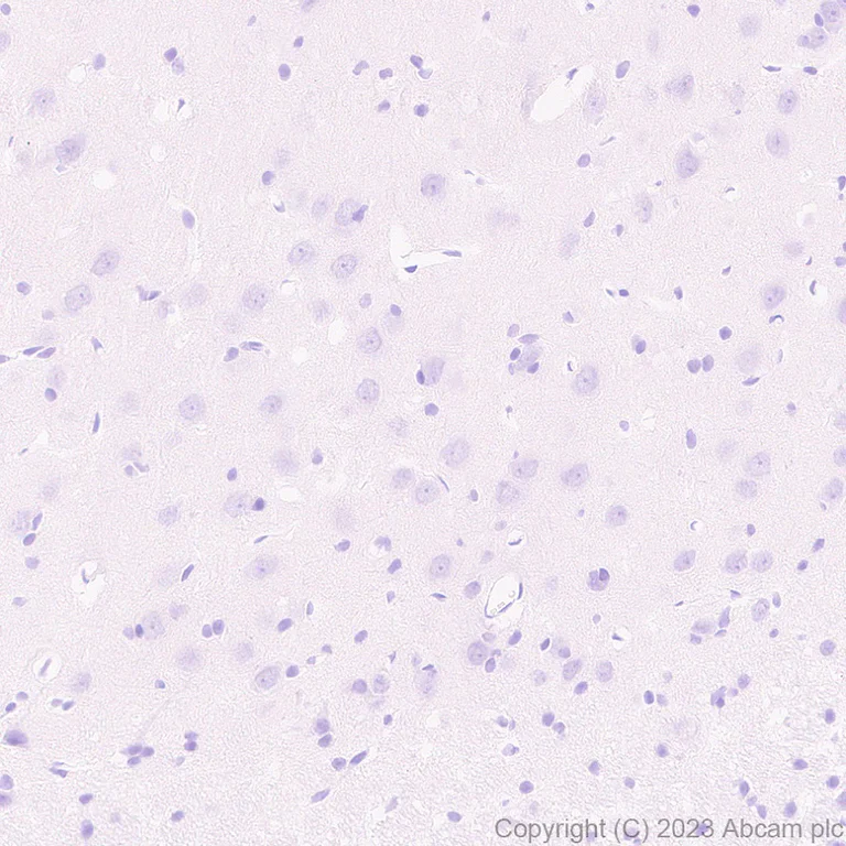 Immunohistochemistry (Formalin/PFA-fixed paraffin-embedded sections) - Anti-Streptococcus mutans Cell surface antigen I/II antibody [EPR28235-11] (AB316006)
