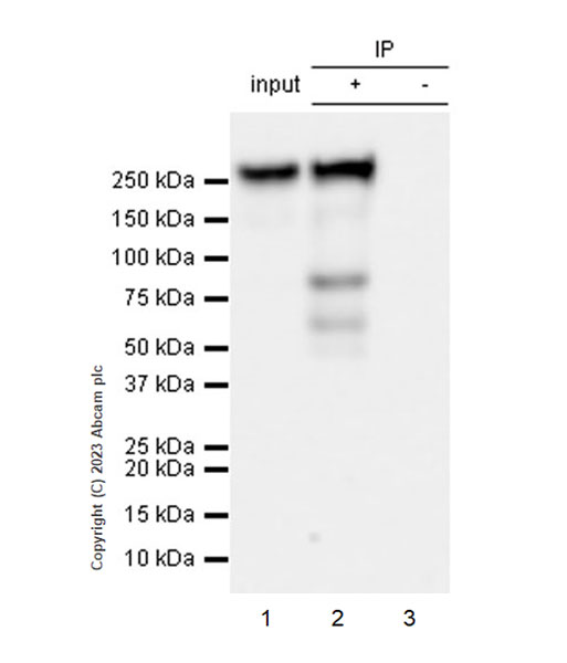 Immunoprecipitation - Anti-Streptococcus mutans Cell surface antigen I/II antibody [EPR28235-11] (ab316006), expandable thumbnail