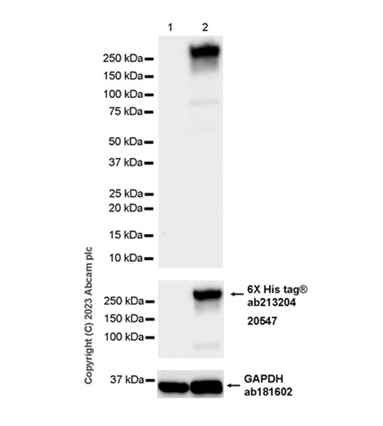 Western blot - Anti-Streptococcus mutans Cell surface antigen I/II antibody [EPR28235-11] (AB316006), expandable thumbnail