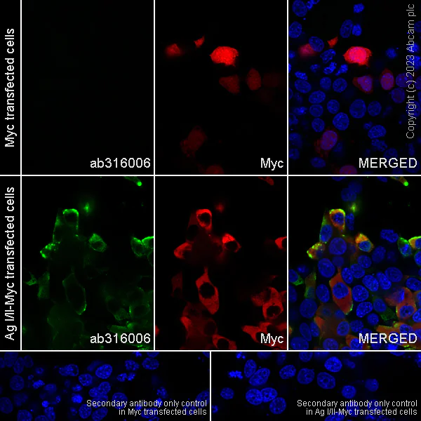 Immunocytochemistry/ Immunofluorescence - Anti-Streptococcus mutans Cell surface antigen I/II antibody [EPR28235-11] - BSA and Azide free (AB316007)