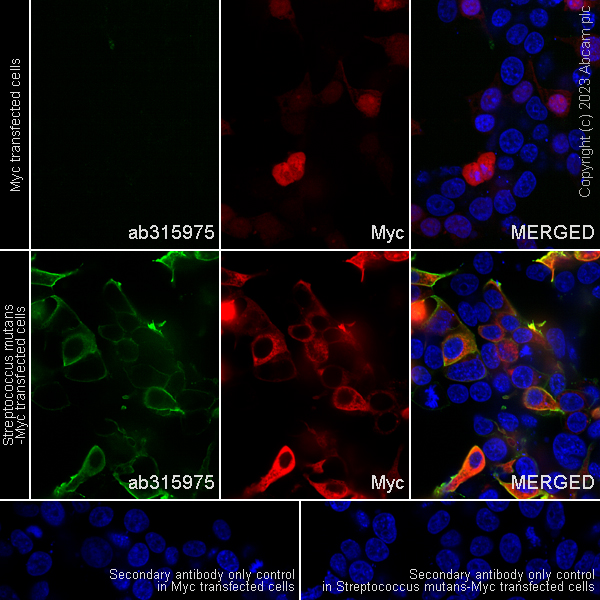 Immunocytochemistry/ Immunofluorescence - Anti-Streptococcus mutans Glucan-binding protein antibody [EPR28235-85] (ab315975), expandable thumbnail
