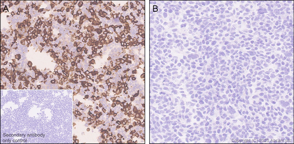 Immunohistochemistry (Formalin/PFA-fixed paraffin-embedded sections) - Anti-Streptococcus mutans Glucan-binding protein antibody [EPR28235-85] (AB315975), expandable thumbnail