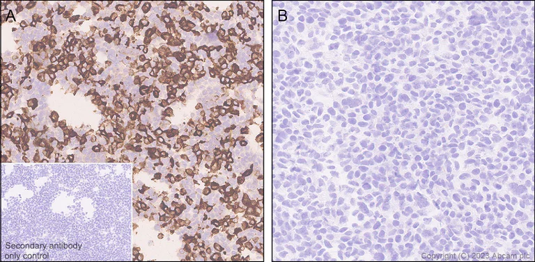 Immunohistochemistry (Formalin/PFA-fixed paraffin-embedded sections) - Anti-Streptococcus mutans Glucan-binding protein antibody [EPR28235-85] (AB315975)