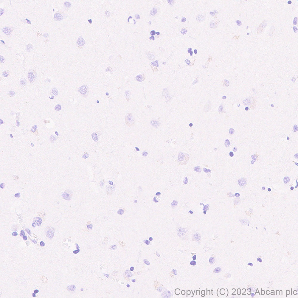Immunohistochemistry (Formalin/PFA-fixed paraffin-embedded sections) - Anti-Streptococcus mutans Glucan-binding protein antibody [EPR28235-85] (AB315975), expandable thumbnail