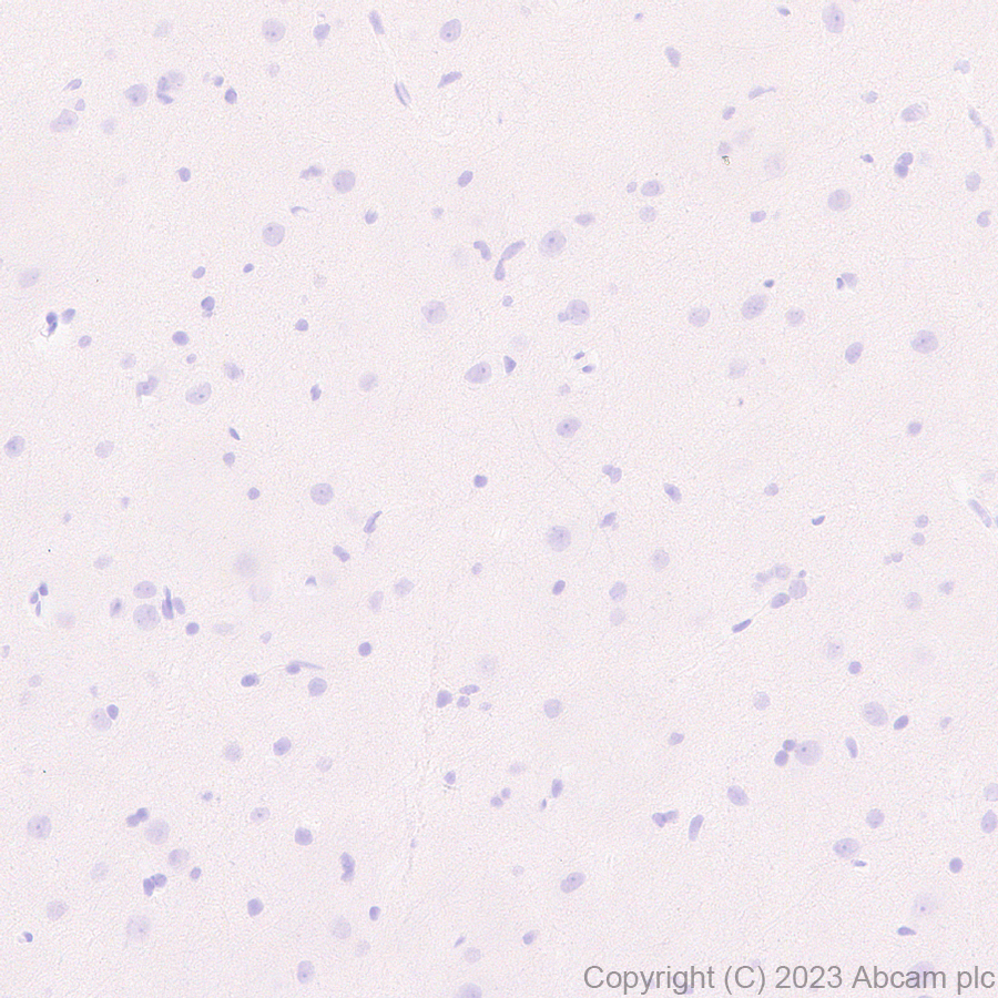 Immunohistochemistry (Formalin/PFA-fixed paraffin-embedded sections) - Anti-Streptococcus mutans Glucan-binding protein antibody [EPR28235-85] (AB315975), expandable thumbnail