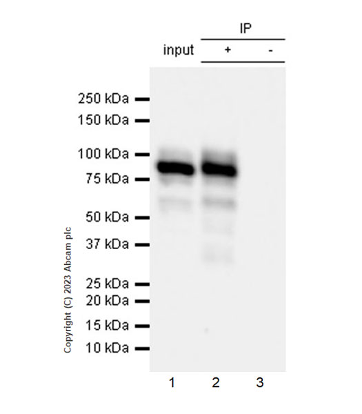 Immunoprecipitation - Anti-Streptococcus mutans Glucan-binding protein antibody [EPR28235-85] (ab315975), expandable thumbnail