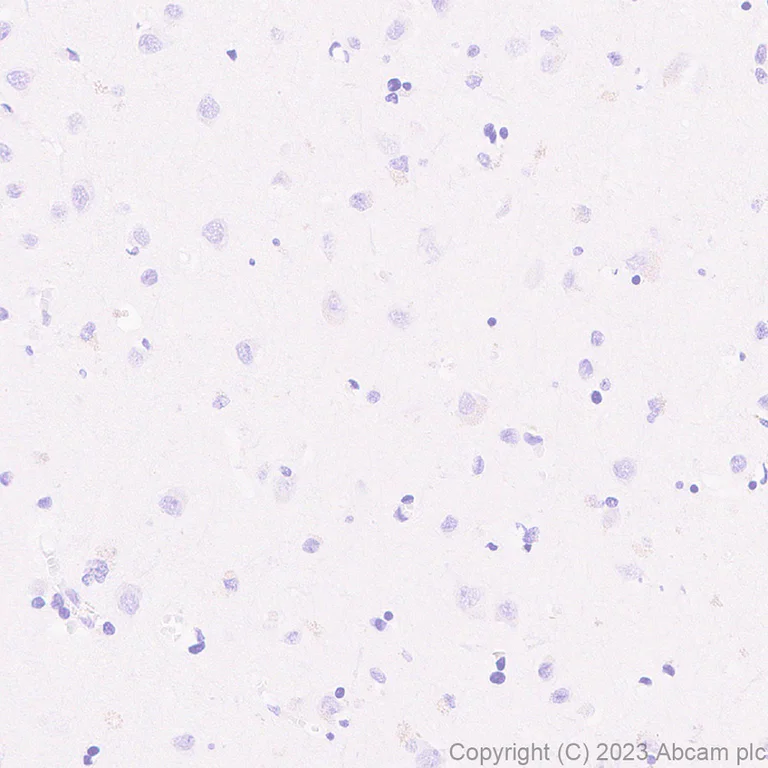Immunohistochemistry (Formalin/PFA-fixed paraffin-embedded sections) - Anti-Streptococcus mutans Glucan-binding protein antibody [EPR28235-85] - BSA and Azide free (AB315976)