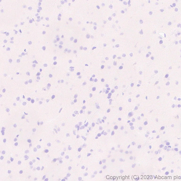 Immunohistochemistry (Formalin/PFA-fixed paraffin-embedded sections) - Anti-Streptococcus mutans Glucan-binding protein antibody [EPR28235-85] - BSA and Azide free (AB315976)