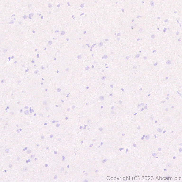 Immunohistochemistry (Formalin/PFA-fixed paraffin-embedded sections) - Anti-Streptococcus mutans Glucan-binding protein antibody [EPR28235-85] - BSA and Azide free (AB315976)