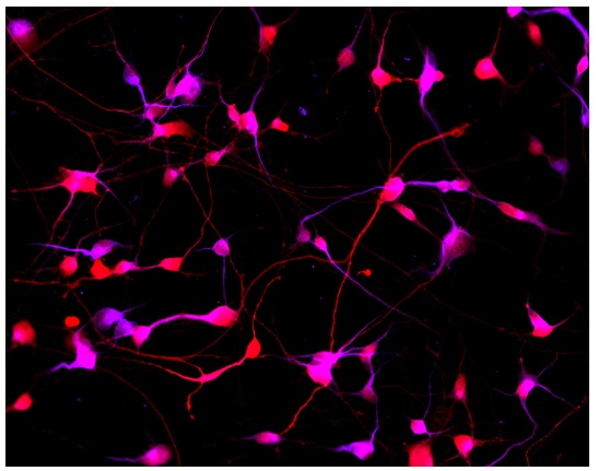 Immunocytochemistry/ Immunofluorescence - Striatal Medium Spiny GABAergic Neurons - Human iPSC derived cells (Male, WC-30) (AB315371), expandable thumbnail
