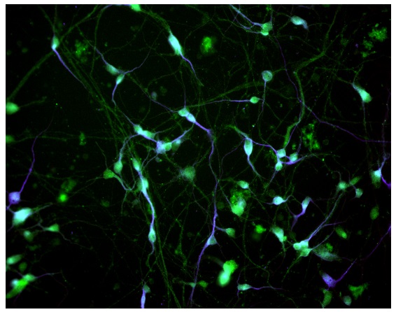 Immunocytochemistry/ Immunofluorescence - Striatal Medium Spiny GABAergic Neurons - Human iPSC derived cells (Male, WC-30) (AB315371), expandable thumbnail