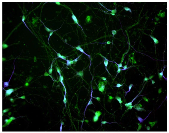 Immunocytochemistry/ Immunofluorescence - Striatal Medium Spiny GABAergic Neurons - Human iPSC derived cells (Male, WC-30) (AB315371)