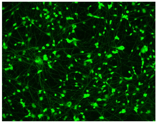 Immunocytochemistry/ Immunofluorescence - Striatal Medium Spiny GABAergic Neurons - Human iPSC derived cells (Male, WC-30) (AB315371), expandable thumbnail