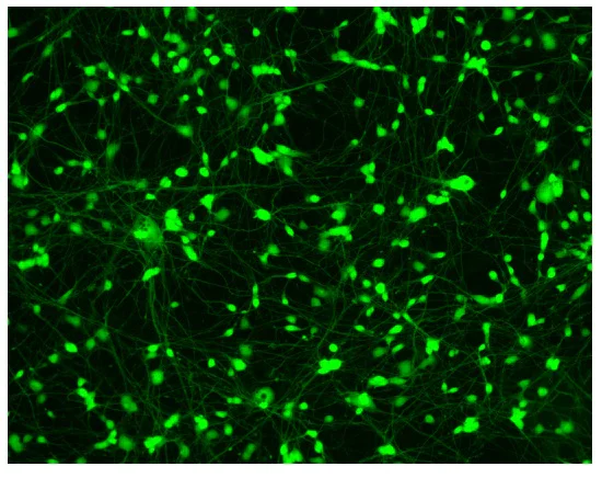 Immunocytochemistry/ Immunofluorescence - Striatal Medium Spiny GABAergic Neurons - Human iPSC derived cells (Male, WC-30) (AB315371)