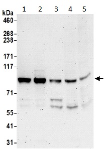 Western blot - Anti-Striatin 4 antibody (AB194948)