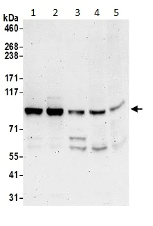 Western blot - Anti-Striatin 4 antibody (AB194948)