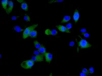 Immunocytochemistry/ Immunofluorescence - Anti-Striatin 4 antibody [EPR11801] - BSA and Azide free (AB249940)
