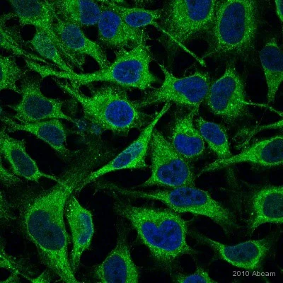 Immunocytochemistry/ Immunofluorescence - Anti-Stromal interaction molecule 1 antibody [5A2] (AB57834)