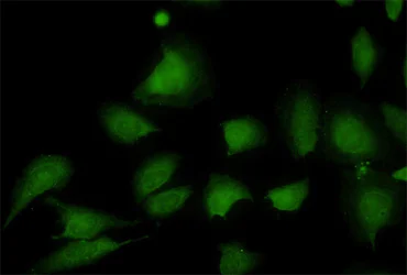 Immunocytochemistry/ Immunofluorescence - Anti-Stromal interaction molecule 1 antibody [5A2] (AB57834)