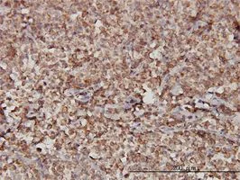 Immunohistochemistry (Formalin/PFA-fixed paraffin-embedded sections) - Anti-Stromal interaction molecule 1 antibody [5A2] (AB57834)