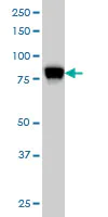Western blot - Anti-Stromal interaction molecule 1 antibody [5A2] (AB57834)