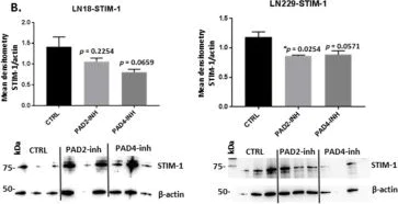 Western blot - Anti-Stromal interaction molecule 1 antibody [5A2] (AB57834)