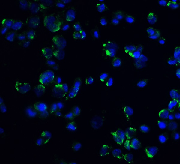 Immunocytochemistry/ Immunofluorescence - Anti-Stromal interaction molecule 1 antibody (AB62031)