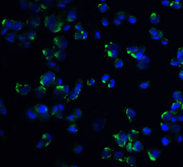 Immunocytochemistry/ Immunofluorescence - Anti-Stromal interaction molecule 1 antibody (AB62031)