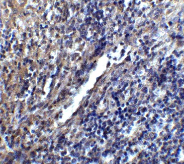 Immunohistochemistry (Formalin/PFA-fixed paraffin-embedded sections) - Anti-Stromal interaction molecule 1 antibody (AB62031)