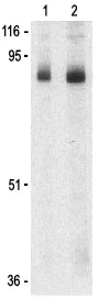 Western blot - Anti-Stromal interaction molecule 1 antibody (AB62031)