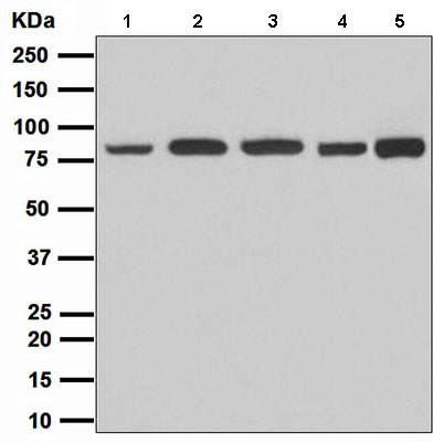 Western blot - Anti-Stromal interaction molecule 1 antibody [EPR3414] (AB108994)
