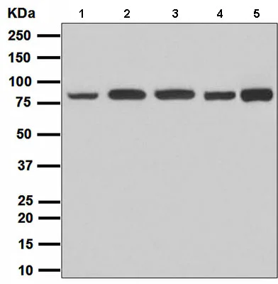 Western blot - Anti-Stromal interaction molecule 1 antibody [EPR3414] (AB108994)