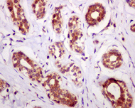 Immunohistochemistry (Formalin/PFA-fixed paraffin-embedded sections) - Anti-Stromal interaction molecule 1 antibody [EPR3414] - BSA and Azide free (AB239938), expandable thumbnail