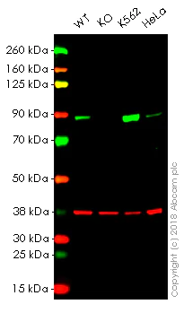 Western blot - Anti-Stromal interaction molecule 1 antibody [EPR3414] - BSA and Azide free (AB239938)