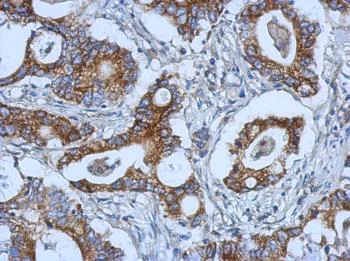 Immunohistochemistry (Formalin/PFA-fixed paraffin-embedded sections) - Anti-Strumpellin antibody (AB126109)