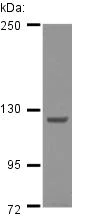Western blot - Anti-Strumpellin antibody (AB126109)