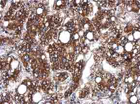 Immunohistochemistry (Formalin/PFA-fixed paraffin-embedded sections) - Anti-Sts1 antibody (AB155307), expandable thumbnail