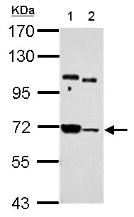 Western blot - Anti-Sts1 antibody (AB155307)