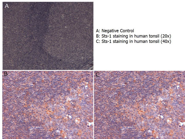 Immunohistochemistry (Formalin/PFA-fixed paraffin-embedded sections) - Anti-Sts1 antibody (AB34781), expandable thumbnail