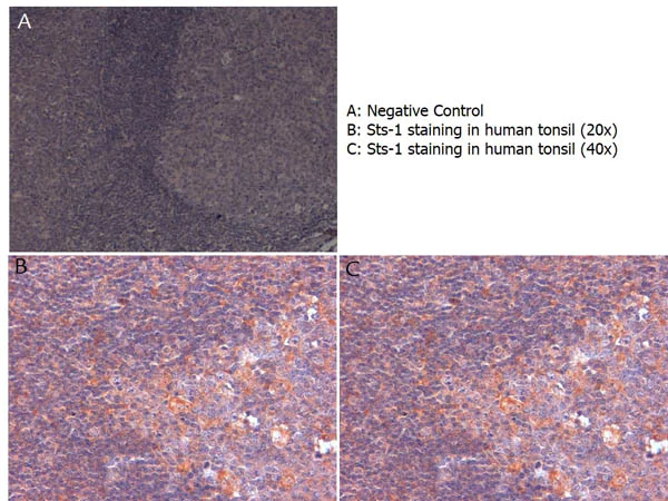 Immunohistochemistry (Formalin/PFA-fixed paraffin-embedded sections) - Anti-Sts1 antibody (AB34781)