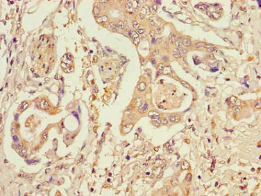 Immunohistochemistry (Formalin/PFA-fixed paraffin-embedded sections) - Anti-STT3A antibody (AB236905)