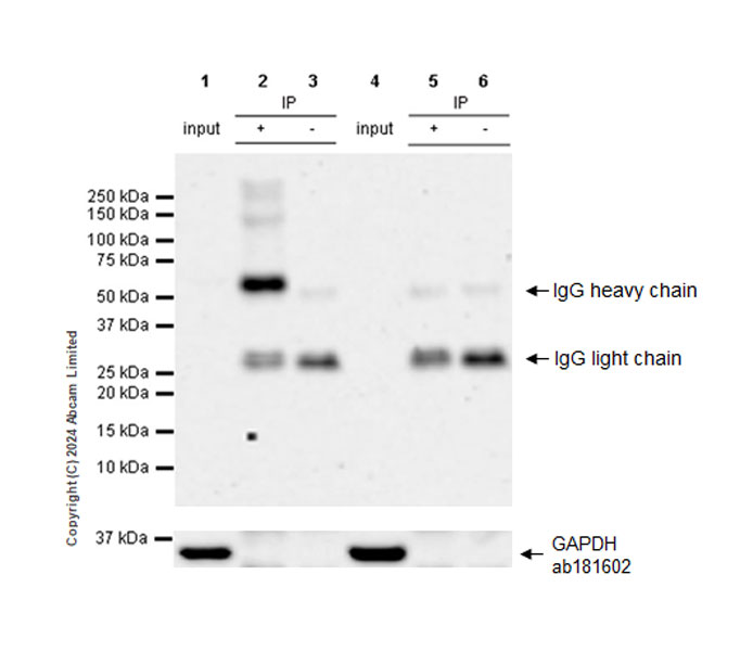 Immunoprecipitation - Anti-STT3A antibody [EPR29178-10] (AB320831)