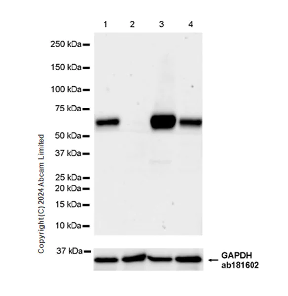 Western blot - Anti-STT3A antibody [EPR29178-10] (AB320831)